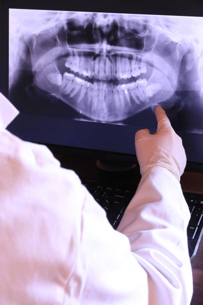 Best Emergency Tooth Extraction in Franklinville, NJ