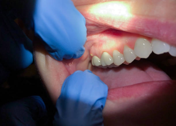 Best Cosmetic Emergency Dentistry in Franklinville, NJ