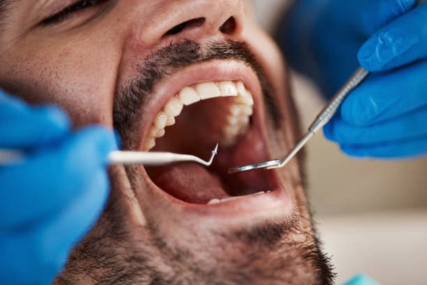 Best Emergency Denture Repair in Franklinville, NJ